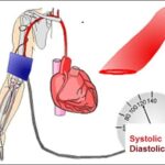 What is High BP and What are signs of high BP?